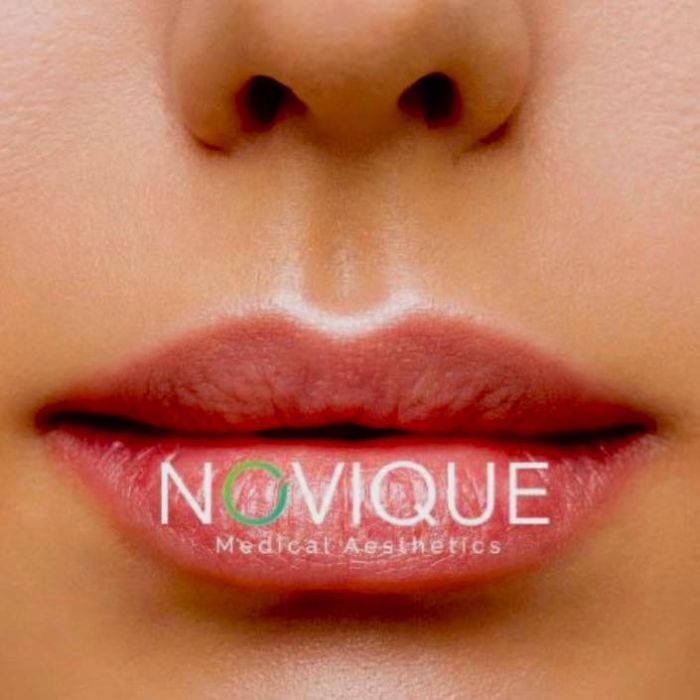 Novique Medical Aesthetics Specials