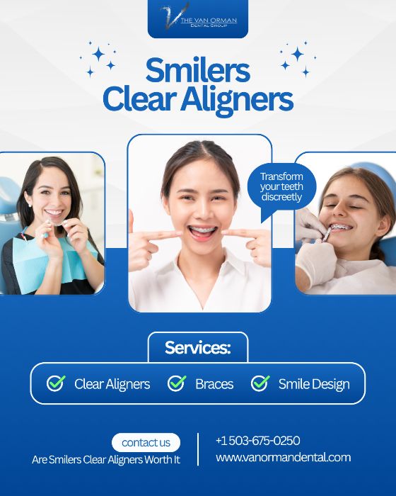 Do Smilers Clear Aligners Really Work?