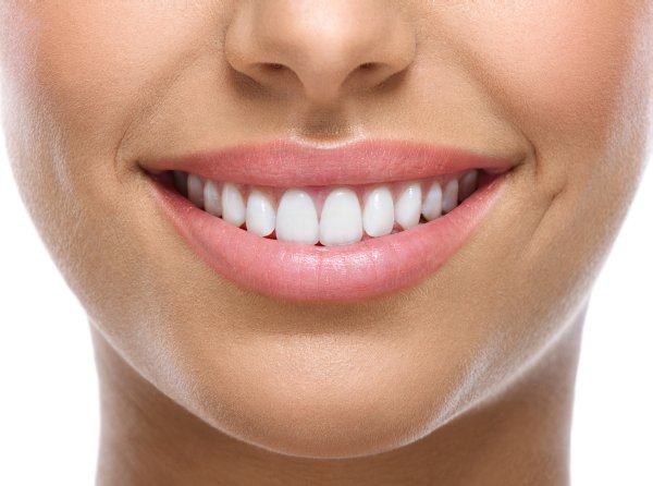 Best Teeth Whitening Treatment in Nassau County by Dr Phil DDS