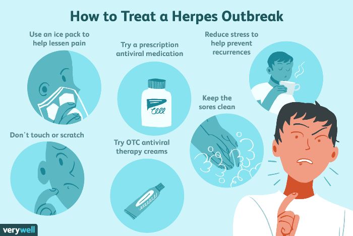 Herpes virus