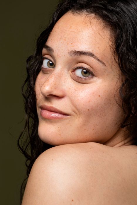 Hyperpigmentation vs. Melasma: Whats the Difference?