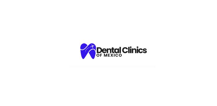 Zygomatic Implants Mexico
