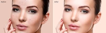 Headshot photo retouching