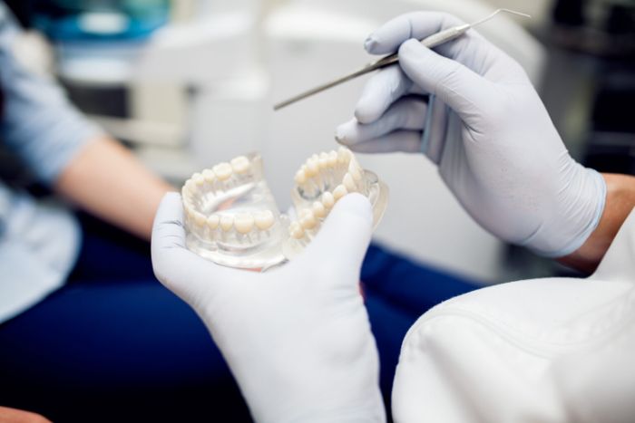 What Are Denture Implants? What Are Denture Implants?