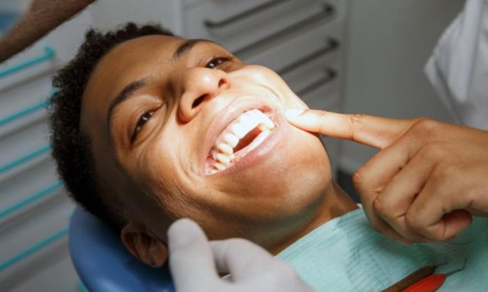Around 45 of all American Children Face Vulnerability to Dental Caries, Says the AAP
