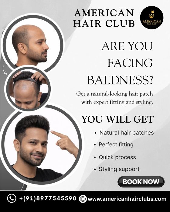Best Hair Patch in Madhapur