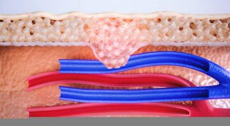 Surgical Wound Healing Services