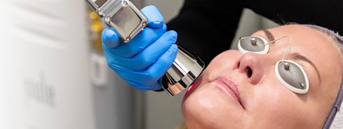 Best Laser Treatment for Aging Skin: Top Solutions for Youthful Glow