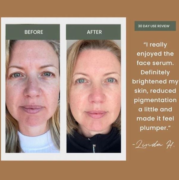 Makeover Your Skin with Australias The Greatest Vitamin C Serums