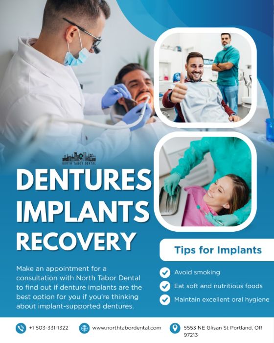 Are denture implants worth it?