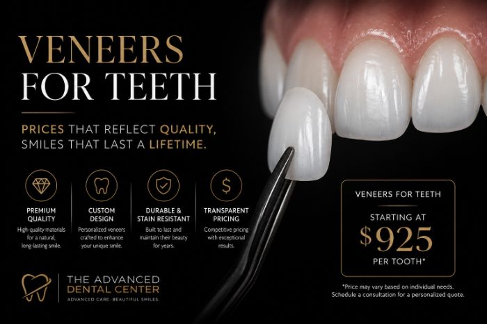 How Much Do Veneers for Teeth Cost?