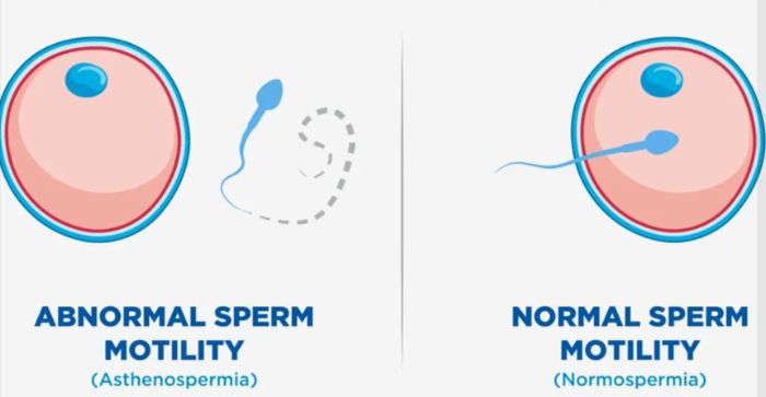 Sperm Testing Near Austin Texas