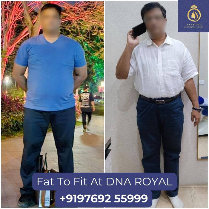 Transform Your Body with Fat Reduction in Thane DNA Royal.