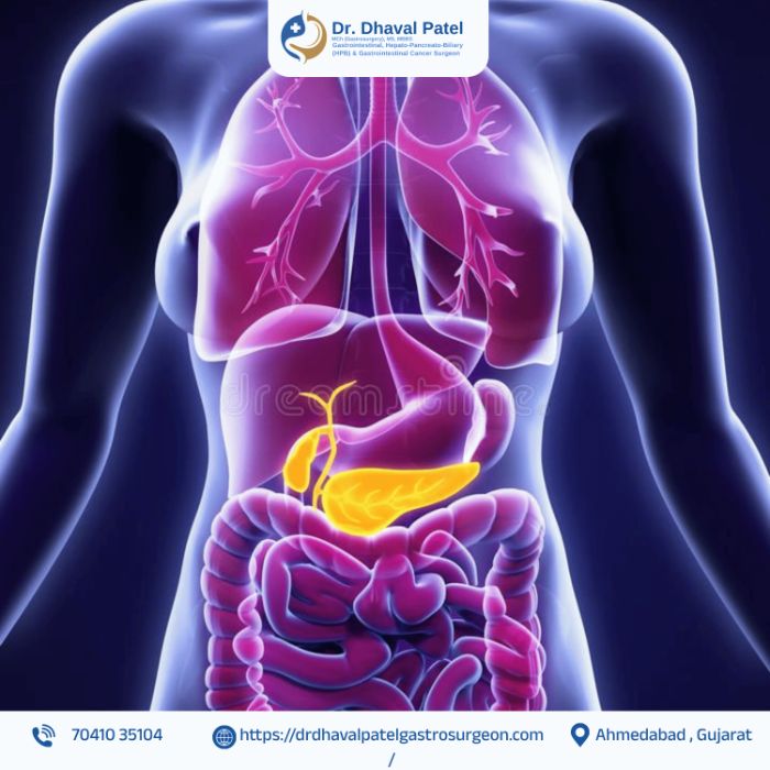 Leading HPB Cancer Specialist in Ahmedabad Dr. Dhaval Patel